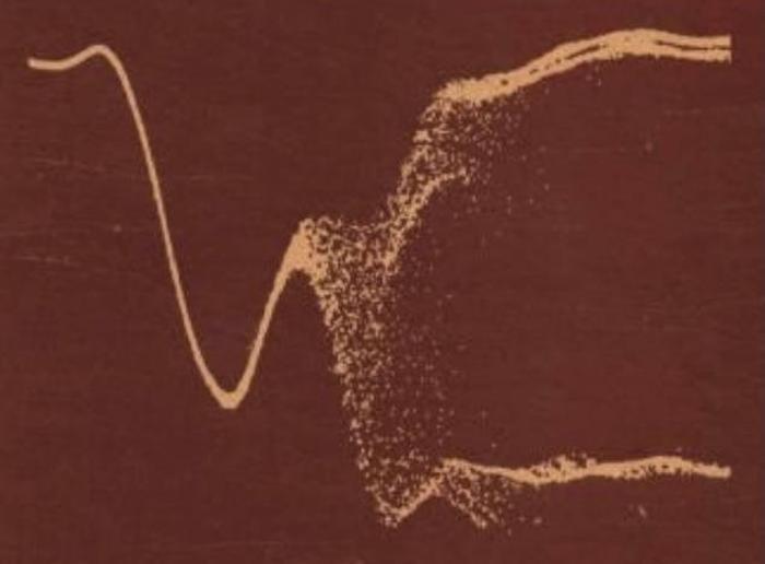 A metastable signal settling to a high or low signal after an indefinite time. This image was used to promote a class on metastability in 1974. From My Work on All Things Metastable by Thomas Chaney.